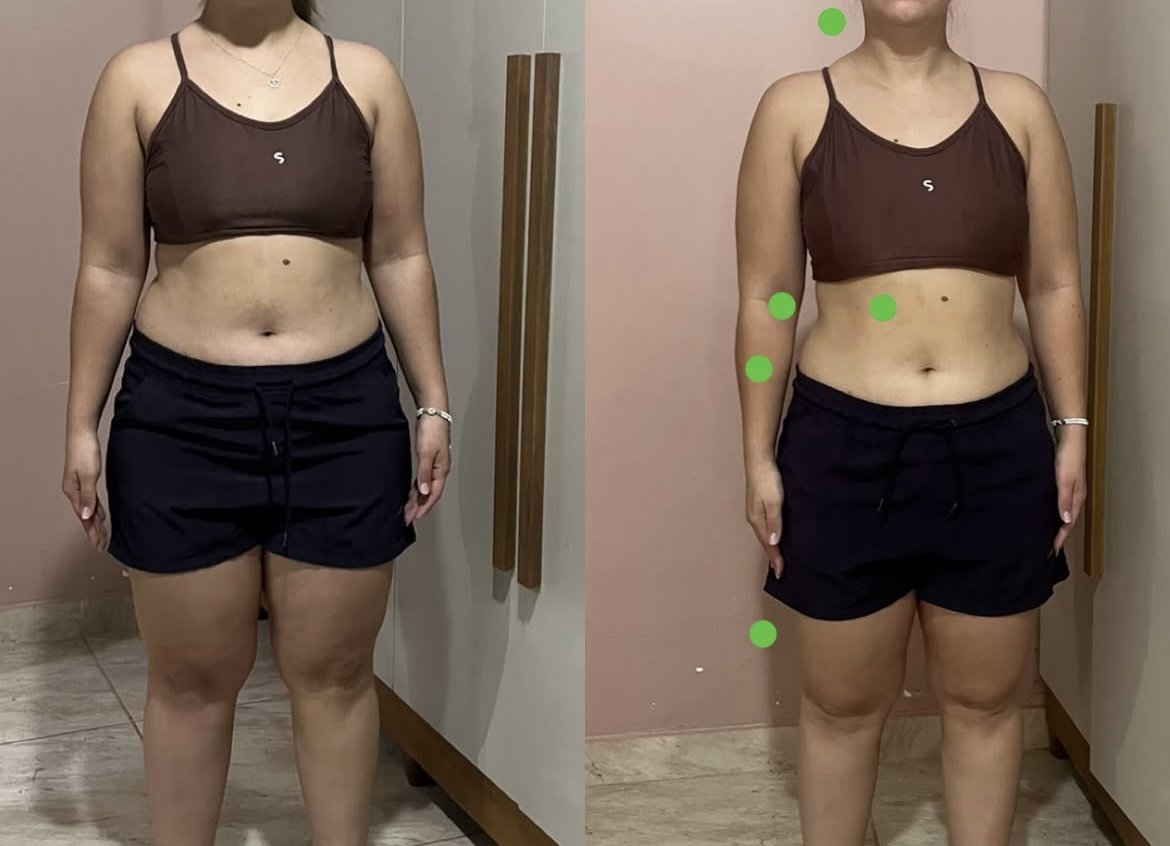 Resultado real de aluna 2 — antes e depois