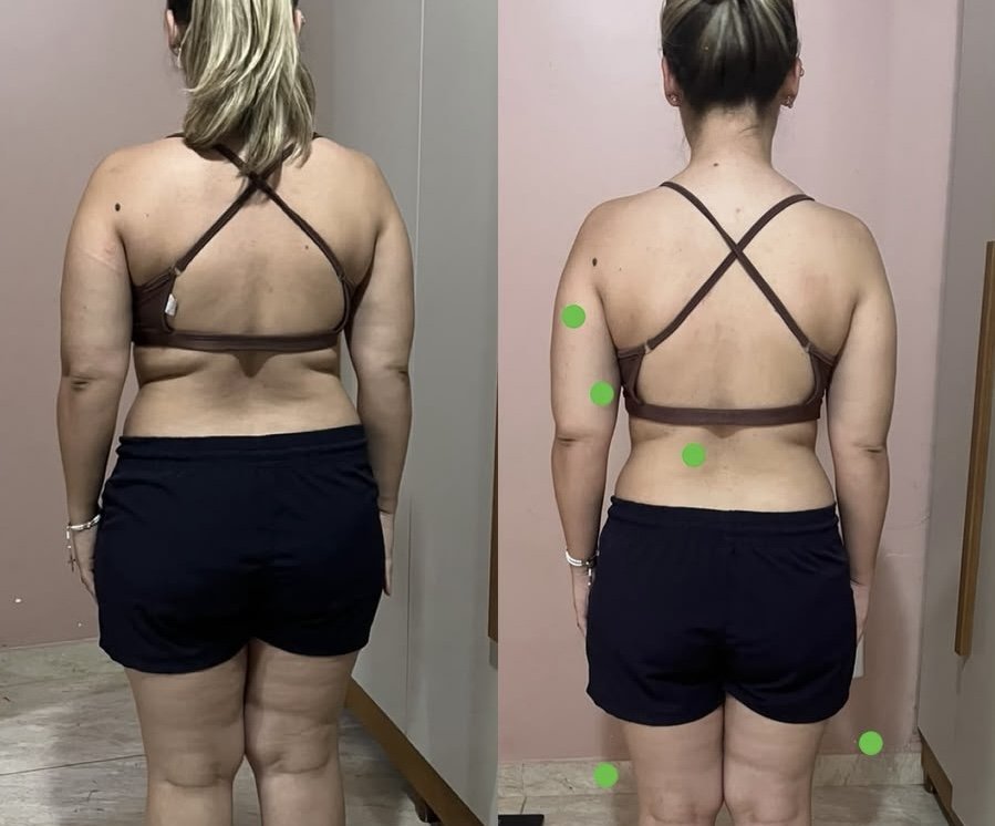 Resultado real de aluna 3 — antes e depois