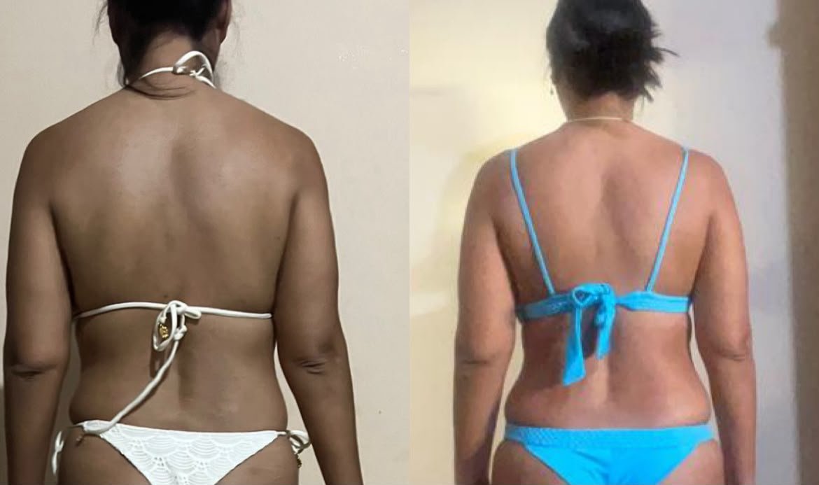 Resultado real de aluna 5 — antes e depois